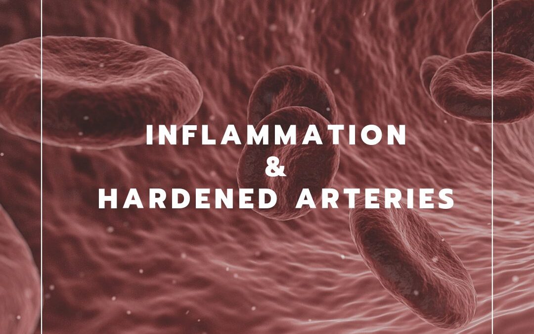 Inflammation and the Food We Eat